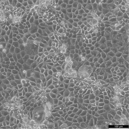 Caco-2 Cells Catalogue Number: 300137