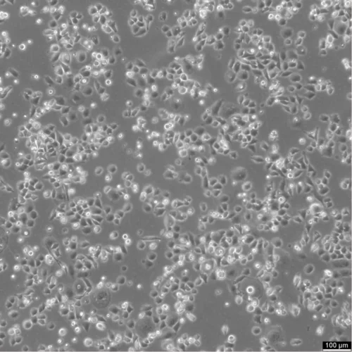 Popular Cell Lines  MX-1 Cell Lines Catalogue Number: 300296